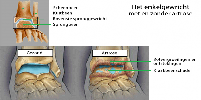 Reuma (thema 5.)